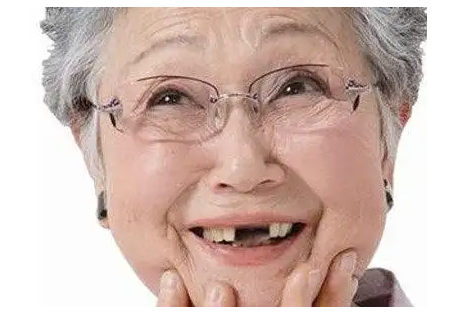 拔牙后多久可以種植牙